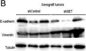 Anti-Vimentin antibody, Mouse monoclonal 