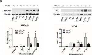 Anti-Vinculin antibody, Mouse monoclonal 