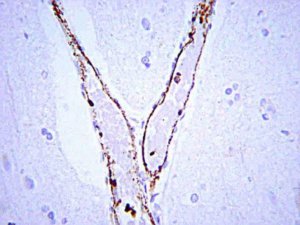 Anti-von Willebrand Factor Antibody 