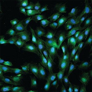 Anti-von Willebrand Factor antibody produced in rabbit 