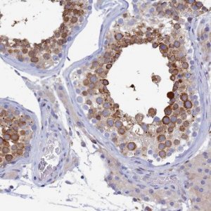 Anti-WDR35 antibody produced in rabbit 