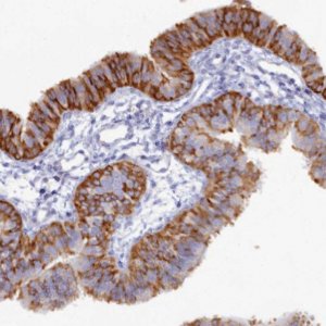 Anti-WDR35 antibody produced in rabbit 