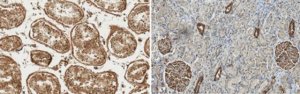 Anti-Wilms Tumor (WT33) 
