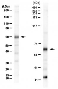 Anti-Wilms Tumor (WT33) 