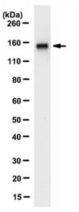 Anti-ZMYM2 Antibody, clone 9F12.1 