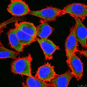 Anti-ZNF175 (OTK18) Antibody, clone 2113.11 