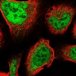 Anti-ZNF281 antibody produced in rabbit 