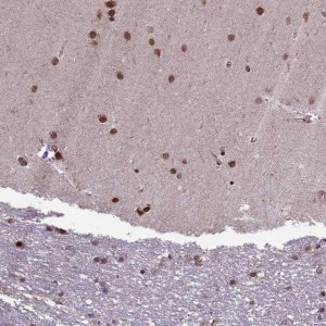 Anti-ZNF598 antibody produced in rabbit 