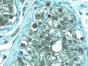 Anti-ZO-1 Antibody 