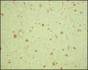 Monoclonal Anti--Amyloid antibody produced in mouse 