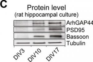 Monoclonal Anti--Tubulin III (neuronal) antibody produced in mouse 