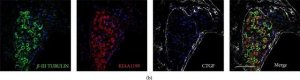 Monoclonal Anti--Tubulin III antibody produced in mouse 