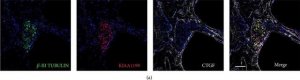 Monoclonal Anti--Tubulin III antibody produced in mouse 