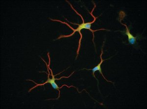 Monoclonal Anti--Tubulin Isotype III antibody produced in mouse 