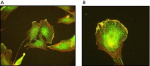 Monoclonal Anti-ARP3 antibody produced in mouse 