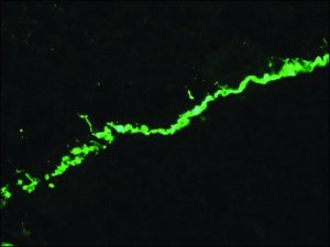 Monoclonal Anti-Collagen, Type VII antibody produced in mouse 