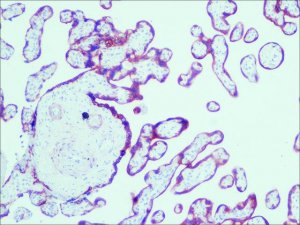 Monoclonal Anti-Cytokeratin, pan antibody produced in mouse 