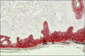Monoclonal Anti-Cytokeratin, pan antibody produced in mouse 