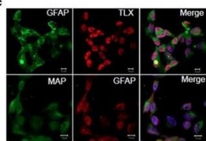 Monoclonal Anti-MAP2 (2a+2b) antibody produced in mouse 