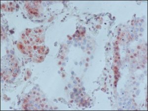 Monoclonal Anti-MeCP2 antibody produced in mouse 