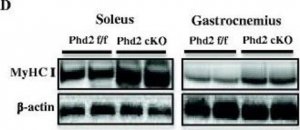 Monoclonal Anti-Myosin (Skeletal, Slow) antibody produced in mouse 