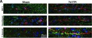 Monoclonal Anti-Neurofilament 200 (Phos. and Non-Phos.) antibody produced in mouse 