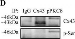 Monoclonal Anti-Phosphoserine antibody produced in mouse 