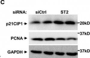 Monoclonal Anti-Proliferating Cell Nuclear Antigen antibody produced in mouse 