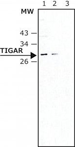 Monoclonal Anti-TIGAR antibody produced in mouse 