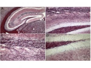 Black Gold II Myelin Staining Kit AG105