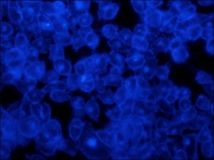 Filipin complex from Streptomyces filipinensis 