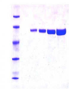Luciferase from Photinus pyralis (firefly) 