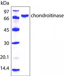 Chondroitinase AC from Flavobacterium heparinum 