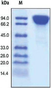 DPPIV/CD26(untagged) human SRP6441-10UG