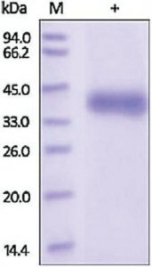Kallikrein-11 human SRP6423-10UG