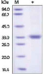 Kallikrein-3 human SRP6421-10UG