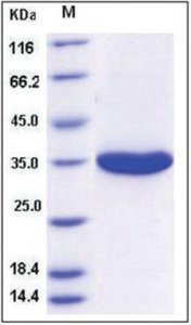 Kallikrein-3 human SRP6058-20UG