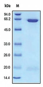 PCSK9 human SRP6285-20UG