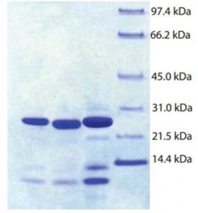 Trypsin Pancreas from human pancreas SRP6311-50UG