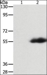 Anti-FLAG Tag antibody produced in rabbit SAB4301135-100UL