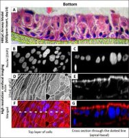 Human Bronchial Epithelial Cells: HBEpC, adult 502-05A