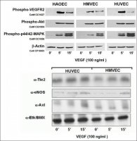 Human Dermal Microvascular Endothelial Cells: CADMEC/HMVEC: Pre-Screened for Angiogenesis & VEGF signaling, adult S100-05A
