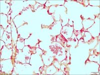 Gram stain for tissue HT90T-1KT