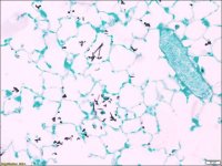 Sodium thiosulfate solution 