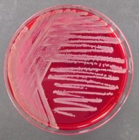 Burkholderia cepacia Selective Agar 