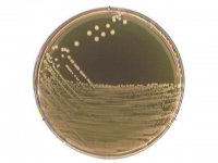 M 17 agar acc. to TERZAGHI 