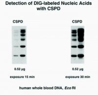 DIG Luminescent Detection Kit 11363514910
