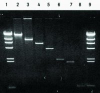 Agarose Gel DNA Extraction Kit 11696505001