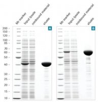 cOmplete His-Tag Purification Column 