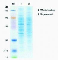 cOmplete Lysis-M 4719956001